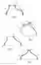Fig. 04 - Urological device having a bladder retainer and a valve