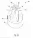 Fig. 07 - Urological device having a bladder retainer and a valve