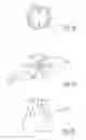 Fig. 09 - Urological device having a bladder retainer and a valve