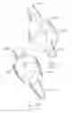Fig. 10 - Urological device having a bladder retainer and a valve