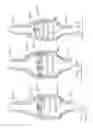 Fig. 13 - Urological device having a bladder retainer and a valve
