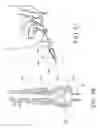 Fig. 20 - Urological device having a bladder retainer and a valve