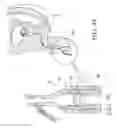 Fig. 21 - Urological device having a bladder retainer and a valve