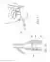 Fig. 22 - Urological device having a bladder retainer and a valve