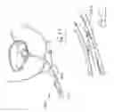 Fig. 24 - Urological device having a bladder retainer and a valve