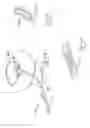 Fig. 25 - Urological device having a bladder retainer and a valve