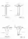 Fig. 33 - Urological device having a bladder retainer and a valve