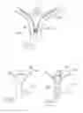 Fig. 34 - Urological device having a bladder retainer and a valve