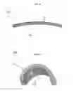Fig. 07 - TENDON AND LIGAMENT FIXATION DEVICE AND METHOD OF USE