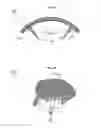Fig. 10 - TENDON AND LIGAMENT FIXATION DEVICE AND METHOD OF USE