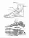 Fig. 14 - TENDON AND LIGAMENT FIXATION DEVICE AND METHOD OF USE