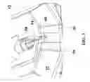 Fig. 04 - Device for cell spraying