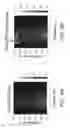 Fig. 09 - Wide depth of focus vortex intraocular lenses and associated methods