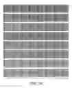 Fig. 29 - Wide depth of focus vortex intraocular lenses and associated methods