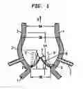 Fig. 02 - Collapsible and re-expandable prosthetic heart valve cuff designs and complementary technological applications