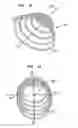 Fig. 10 - Collapsible and re-expandable prosthetic heart valve cuff designs and complementary technological applications