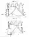 Fig. 11 - Collapsible and re-expandable prosthetic heart valve cuff designs and complementary technological applications
