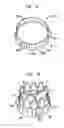 Fig. 12 - Collapsible and re-expandable prosthetic heart valve cuff designs and complementary technological applications