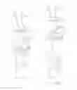 Fig. 41 - Systems and methods for delivering a medical implant