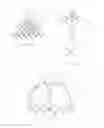Fig. 76 - Systems and methods for delivering a medical implant