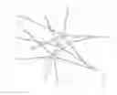 Fig. 95 - Systems and methods for delivering a medical implant