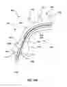 Fig. 28 - Delivery device for a stented prosthetic heart valve