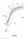 Fig. 29 - Delivery device for a stented prosthetic heart valve