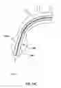Fig. 30 - Delivery device for a stented prosthetic heart valve