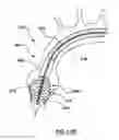 Fig. 31 - Delivery device for a stented prosthetic heart valve