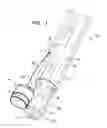 Fig. 02 - Implantation of flexible implant