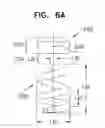 Fig. 13 - Implantation of flexible implant