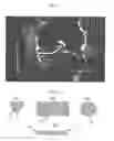 Fig. 02 - Osteoarthritis treatment and device