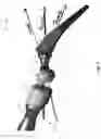 Fig. 08 - Bone preparation apparatus and method