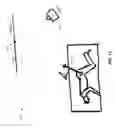 Fig. 13 - Bone preparation apparatus and method