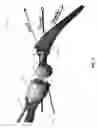 Fig. 08 - SURGICAL IMPACTION CENTERING APPARATUS AND METHOD