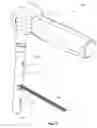 Fig. 08 - Force sense measurement in prosthesis installation