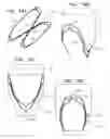 Fig. 12 - DEVICES AND METHODS FOR CONTROL OF BLOOD PRESSURE