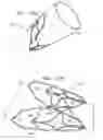 Fig. 13 - DEVICES AND METHODS FOR CONTROL OF BLOOD PRESSURE