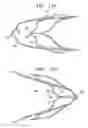 Fig. 14 - DEVICES AND METHODS FOR CONTROL OF BLOOD PRESSURE