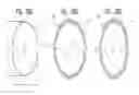 Fig. 24 - DEVICES AND METHODS FOR CONTROL OF BLOOD PRESSURE