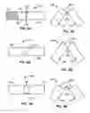 Fig. 04 - Systems and methods for deploying a luminal prosthesis over a carina