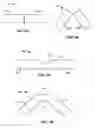 Fig. 05 - Systems and methods for deploying a luminal prosthesis over a carina