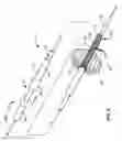 Fig. 06 - Systems and methods for deploying a luminal prosthesis over a carina