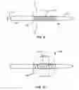 Fig. 07 - Systems and methods for deploying a luminal prosthesis over a carina