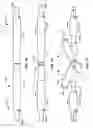 Fig. 09 - Systems and methods for deploying a luminal prosthesis over a carina