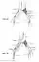 Fig. 10 - Systems and methods for deploying a luminal prosthesis over a carina