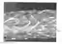 Fig. 01 - HELICAL HYBRID STENT