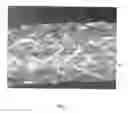 Fig. 02 - HELICAL HYBRID STENT