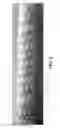 Fig. 07 - HELICAL HYBRID STENT