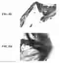 Fig. 16 - Stents having protruding drug-delivery features and associated systems and methods